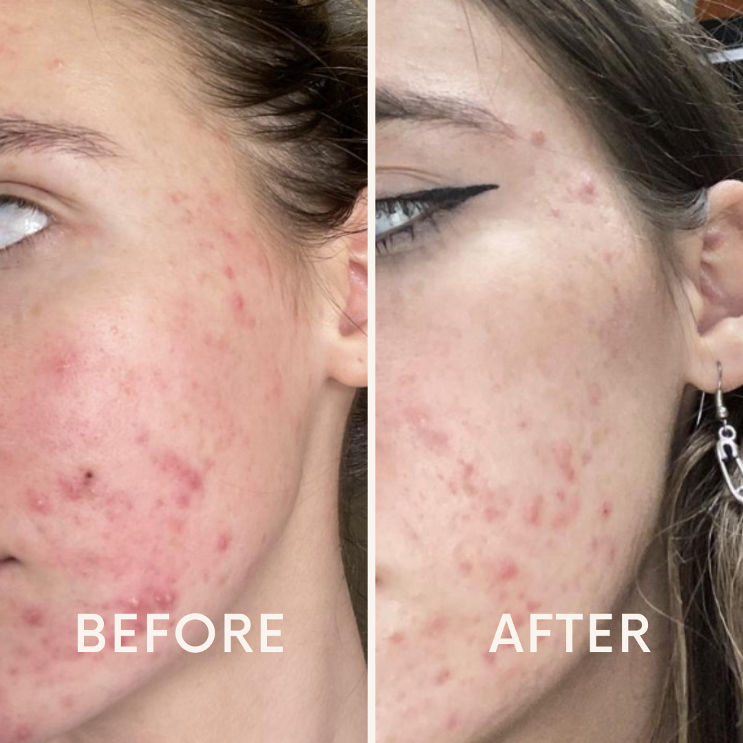 Pore Wash + FREE Pore Cleansing Pads
