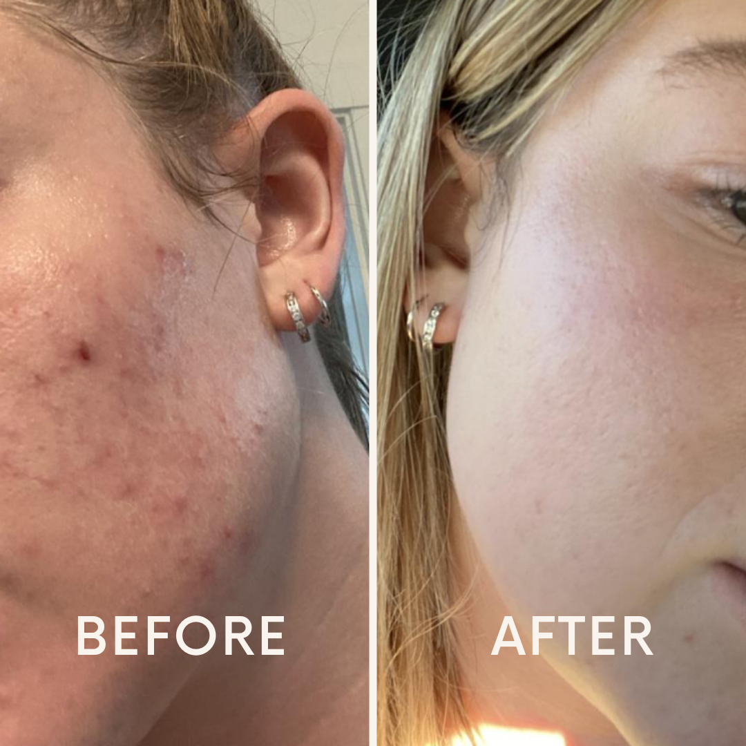 Pore Wash + FREE Pore Cleansing Pads