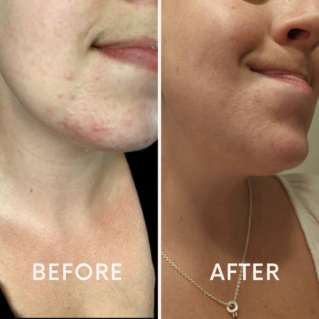 Pore Wash + FREE Pore Cleansing Pads