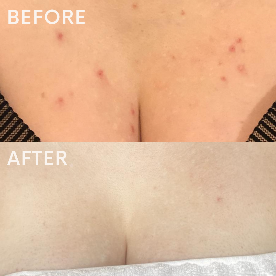 It's Pore-fect Wash