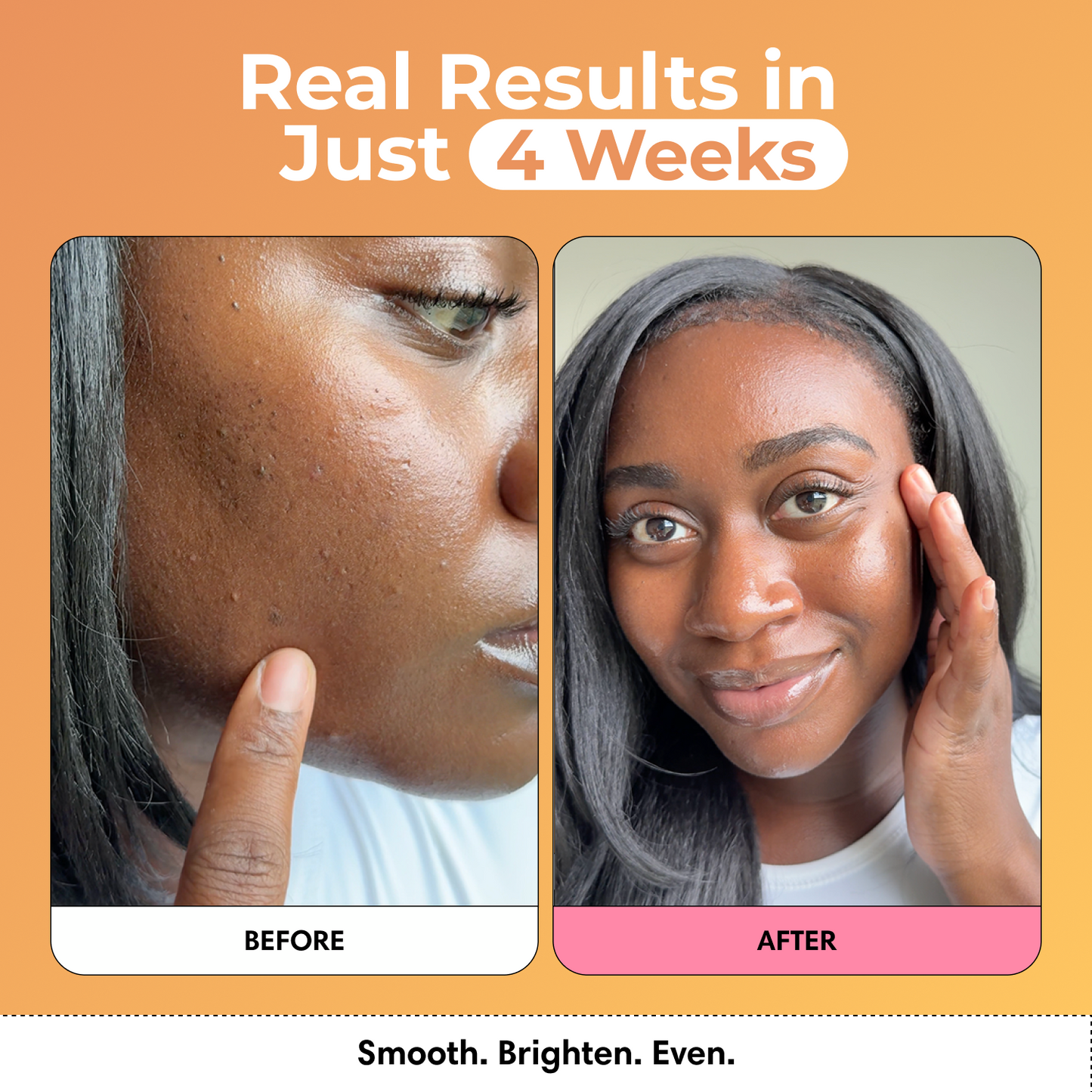 Brightening Duo – Glow Bubble Mask & Wash for Dark Spots
