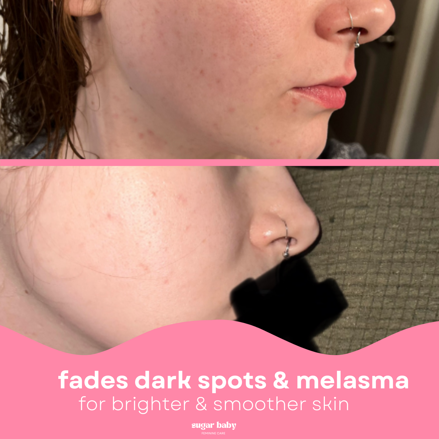 2 Glow Up Pads + FREE Glow Serum